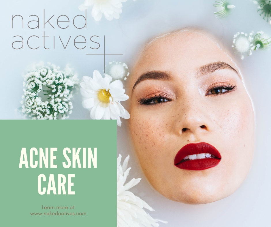 Adult Acne- Understanding causes, treatment options and Care routine